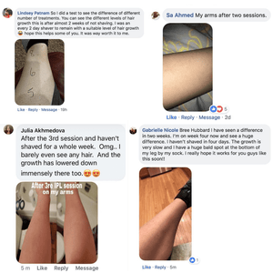 SnowySkin™ IPL Laser Hair Removal Handset