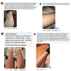 SnowySkin™ IPL Laser Hair Removal Handset