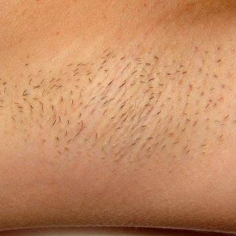 Customer underarms before