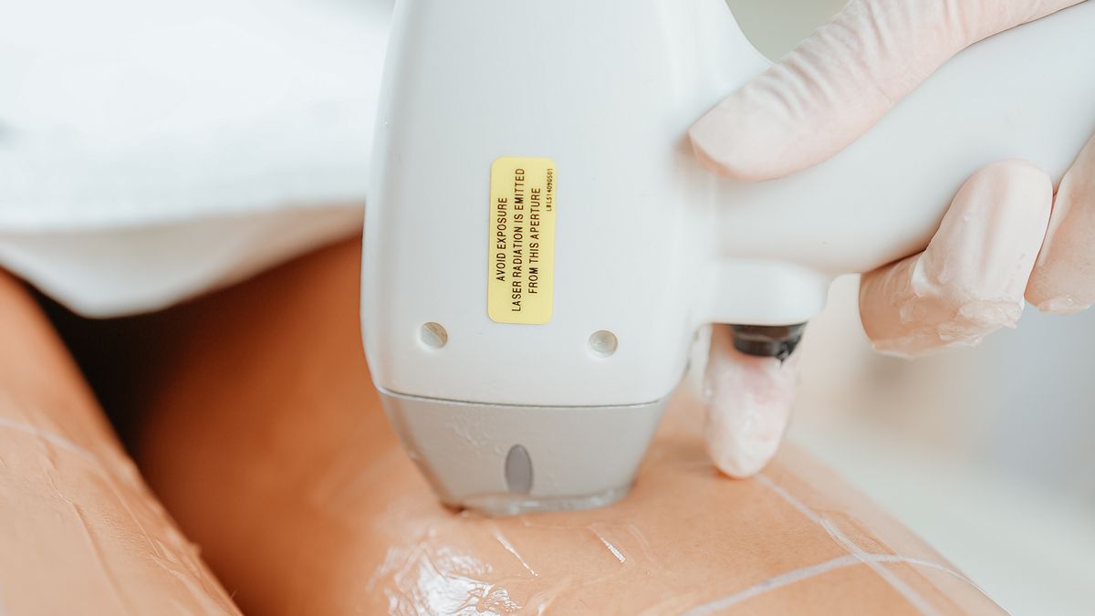 Laser hair removal treatment being performed on a leg in a clinic, illustrating whether laser hair removal hurts