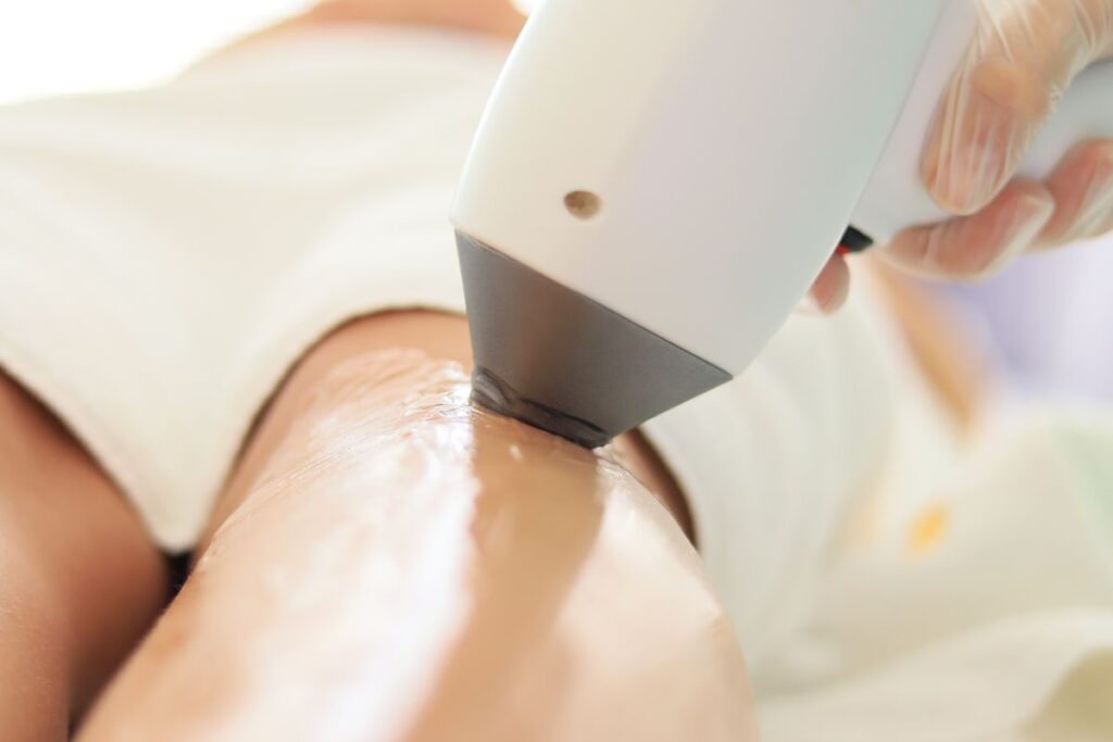 Does laser hair removal hurt — close-up of a laser handpiece treating the leg in a professional clinic