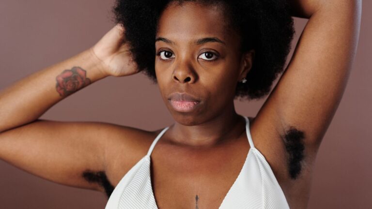 Woman with raised arms and smooth underarms, illustrating how to get rid of dark underarms